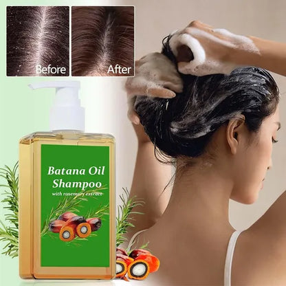 Shampoo Batana Crecimiento Cabello